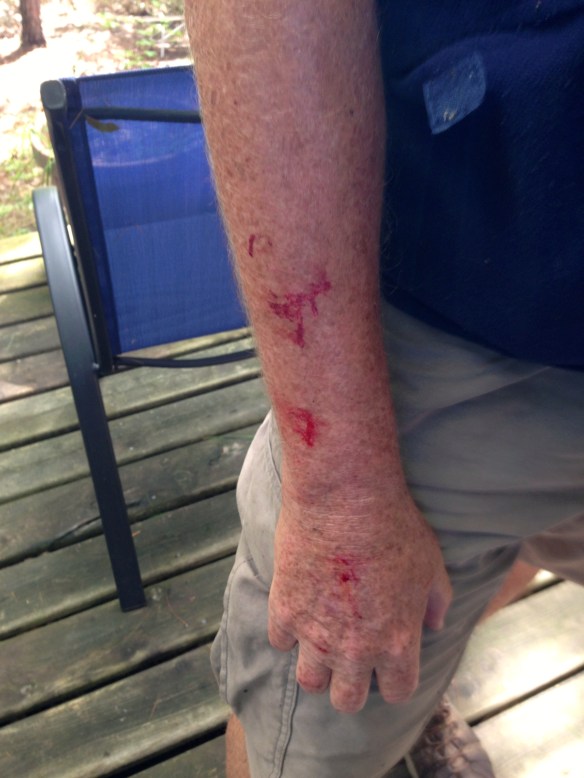 Scratches from today's ride.