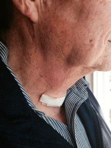 After surgery, the next day